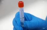 dépistage coronavirus 