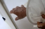 moustique spray 