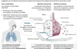 Quand le système immunitaire s'emballe