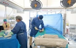 operation au service des grands brulés au CHU nord 