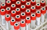 test coronavirus 
