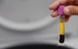  chikungunya analyse sang 