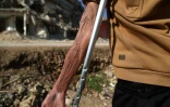 Hamza al-Ahmed montre son bras qui a été broyé dans le tremblement de terre de février 2023, dans le camp où il vit à Jindayris, au nord-ouest de la province d'Alep, le 2 février 2024 en Syrie
