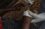 Une patiente atteinte du mpox reçoit un traitement en intraveineuse à l'hôpital de Kavumu, au nord de Bukavu, dans l'est de la RDC, le 24 août 2024