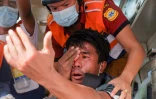 Photo prise le 20 février 2021 montrant un manifestant blessé à l'oeil à Mandalay, Birmanie