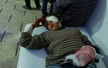 Un enfant syrien blessé hospitalisé dans la ville bombardée de Douma, le fief rebelle de la Ghouta orientale, aux portes de Damas, le 23 février 2018