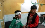 Un enfant syrien blessé pleure dans une clinique à Douma, dans la Ghouta orientale bombardée par le régime, le 24 février 2018