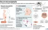 Zika et microcéphalie