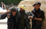 Un homme blessé dans des frappes menées par l'aviation du régime le 31 mars 2016 à Deir al-Assafien Syrie