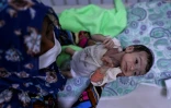 Un bébé souffrant de malnutrition, reçoit un traitement dans un centre de MSF, près de Hérat, le 22 novembre 2021 en Afghanistan