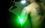 Sandi Widodo travaille sur un client musulman qui souhaite effacer ses tatouages, le 18 avril 2018 à Jakarta, en Indonésie