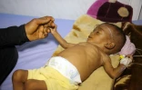Un enfant yéménite reçoit des soins dans un hôpital de la ville de Hodeida, le 11 novembre 2017