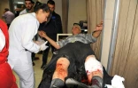 Photo fournie par l'agence de presse officielle syrienne Sana le 7 avril 2018 montrant un homme blessé recevant des soins dans un hôpital de la capitale syrienne Damas après des tirs de roquettes