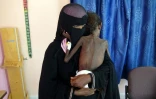 Une photo prise le 22 novembre 2018 montre une mère yéménite Nadia Nahari tenant son fils de cinq ans Abdelrahman, qui souffre de malnutrition sévère et pèse cinq kilos, dans une clinique dans la ville de Khokha, dans la province de Hodeida dans l'ouest du Yémen