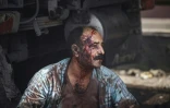 Un homme blessé sur une autoroute près du port iranien de Shahid Rajaï, secoué par une puissante explosion qui a fait plus de 500 blessés, le 26 avril 2025