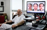 Le professeur Laurent Lantieri (d) et sur un écran d'ordinateur les trois visages de Jérôme Hamon, premier homme au monde à avoir subi deux greffes de la face, le 13 avril 2018 à l'hôpital européen Georges-Pompidou, à Paris