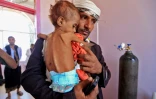 Un Yéménite portant dans ses bras son enfant souffrant de malnutrition. Photo prise le 6 octobre 2018 dans un hôpital de Sanaa