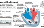 Le coeur artificiel Carmat