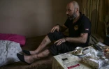 Serguei Davidian, 39 ans, montre les blessures reçues en octobre 2020 au Haut-Karabakh, dans sa petite maison d'Erevan le 3 octobre 2023