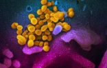 Le virus SARS-CoV-2 (en jaune) à la surface d'une cellule humaine (en bleu) cultivée en laboratoire en février 2020 à Washington