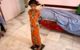 Fatima Hadi, une Yéménite déplacée de 12 ans souffrant de malnutrition aiguë, est pesée dans un hôpital de la province de Hajjah (nord-ouest) la 25 février 2019