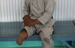 Ahmad Sayed Rahman a perdu sa jambe droite quand il a été atteint par des tirs entre belligérants, alors qu'il avait huit mois, ici à l'hôpital du comité international de la Croix Rouge, à Kaboul, le 7 mai 2019