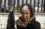 Une fillette blessée après avoir fui le dernier réduit du groupe jihadiste Etat islamique (EI), le 13 février 2019 dans la province orientale de Deir Ezzor