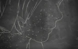 La variole du singe
