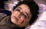 Omar, un garçon de 10 ans blessé dans un raid aérien qui a tué plusieurs membres de sa famille, reçoit des soins dans un hôpital de fortune dans la Ghouta orientale, une enclave rebelle près de Damas bombardée par le régime syrien le 25 février 2018