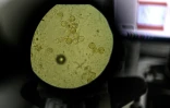 Des particules de pollen étudiées au microscope dans le laboratoire d'analyses de l'entreprise Famille Michaud Apiculteurs, le 12 juin 2025 à Gan, dans les Pyrénées-Atlantiques 
