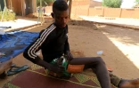 Une jeune survivant d'une attaque jihadiste montre ses blessures, le 9 janvier 2021, dans un camp de déplacés à Ouallam, au Niger.