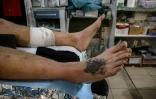 Un soldat ukrainien blessé par un drone russe FPV, dans un centre de stabilisation près de la ligne de front dans l'est de l'Ukraine, le 10 octobre 2025