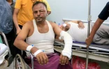 Des hommes blessés lors de frappes israéliennes sur le port de Hodeida, ville du Yémen tenue par les Houthis, reçoivent des soins dans un hôpital, le 21 juillet 2024