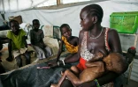 Des enfants soufrant de malnutrition dans une clinique des Médecins sans frontiÚres à Lankien, au Soudan du Sud, le 8 avril 2016