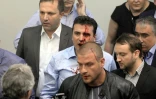 le leader de l'opposition de gauche Zoran Zaev, le visage ensanglanté, dans le chaos qui a suivi l'irruption dans l'hémicycle des  sympathisants du VMRO-DPMNE de l'ex-Premier ministre Nikola Gruevski, le 27 avril 2017 à Skopje 