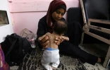 Une jeune mère palestinienne et son bébé souffrant de malnutrition à l'hôpital Nasser de Khan Younès, dans le sud de la bande de Gaza, le 24 juillet 2025