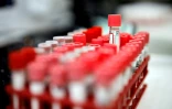 Tests sérologiques pour rechercher le Covid-19 analysés par un laboratoire en région parisienne, le 22 avril 2020