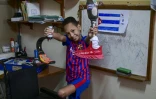 Juan Jose Guilarte chez lui montre ses deux prothèses, à La Havane, le 22 avril 2026 à Cuba