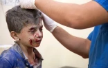 Un garçonnet, dont la maison a été détruite par un un bombardement, est soigné dans un hôpital de fortune d'Alep, le 24 septembre 2016