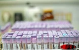 Jeudi 16  février 2006

Le laboratoire de biologie du CHD de Bellepierre (Saint-Denis) pratique quotidiennement une soixantaine de mises en évidence du virus du chikungunya