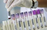 Jeudi 16  février 2006

Le laboratoire de biologie du CHD de Bellepierre (Saint-Denis) pratique quotidiennement une soixantaine de mises en évidence du virus du chikungunya