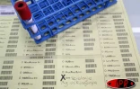 Jeudi 16  février 2006

Le laboratoire de biologie du CHD de Bellepierre (Saint-Denis) pratique quotidiennement une soixantaine de mises en évidence du virus du chikungunya