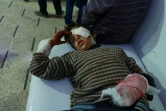 Un enfant syrien blessé hospitalisé dans la ville bombardée de Douma, le fief rebelle de la Ghouta orientale, aux portes de Damas, le 23 février 2018