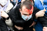 Un manifestant d'opposition blessé, le 23 janvier 2021 à Moscou
