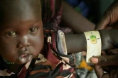 Un petit garçon soigné au centre de soins d'Udier, au Soudan du Sud, le 7 mars 2019