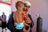 Un Yéménite portant dans ses bras son enfant souffrant de malnutrition. Photo prise le 6 octobre 2018 dans un hôpital de Sanaa