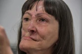 Denise Vicentin,défigurée après un cancer se regarde dans un miroir après une reconstruction à Sao Paulo, le 3 décembre 2019