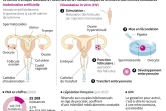 La procréation médicalement assistée (PMA)