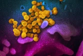Le virus SARS-CoV-2 (en jaune) à la surface d'une cellule humaine (en bleu) cultivée en laboratoire en février 2020 à Washington