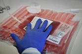 Poches de sang préparées en vue d'une modification génétique de certaines cellules